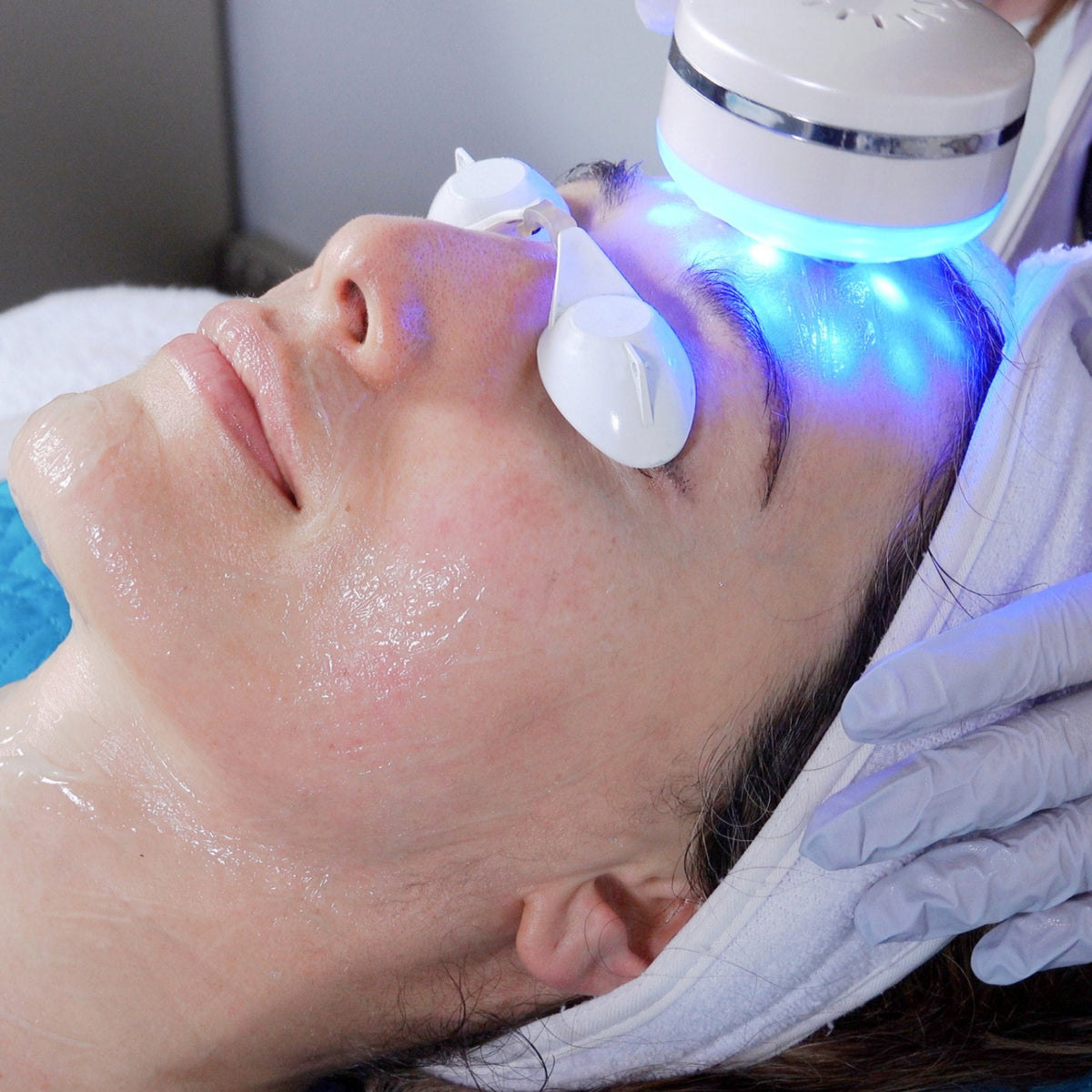 Skincare Before and After Laser Treatment: A Complete Guide