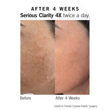 Serious Clarity 4x Serum - NEOVA