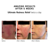 Ultimate Redness Relief - NEOVA