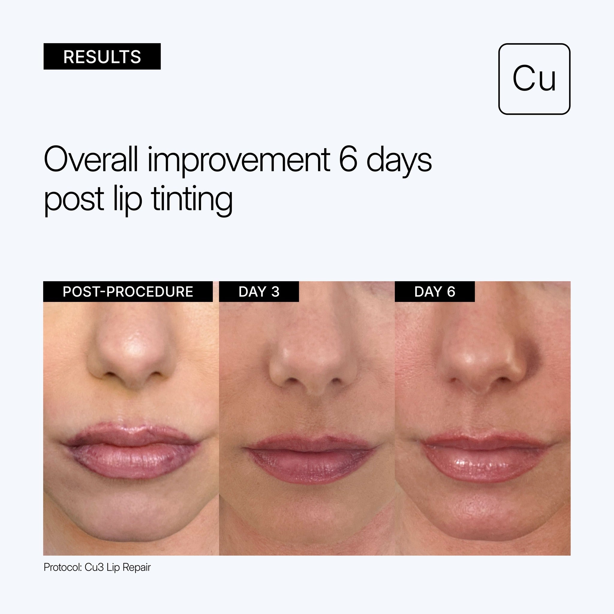 NEOVA Cu3 Lip Repair educational image showing clinical before and after results Post-Procedure, Day 3 and Day 6 with text reading 'Overall improvement 6 days post lip tinting' on a light background.