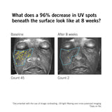 Before and after results showing reduced appearance of UV spots after using NEOVA DNA Total Repair