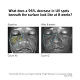 Before and after results showing reduced appearance of UV spots after using NEOVA DNA Total Repair