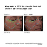 Before and after results showing reduction in the appearance of fine lines and wrinkles with NEOVA DNA Total Repair