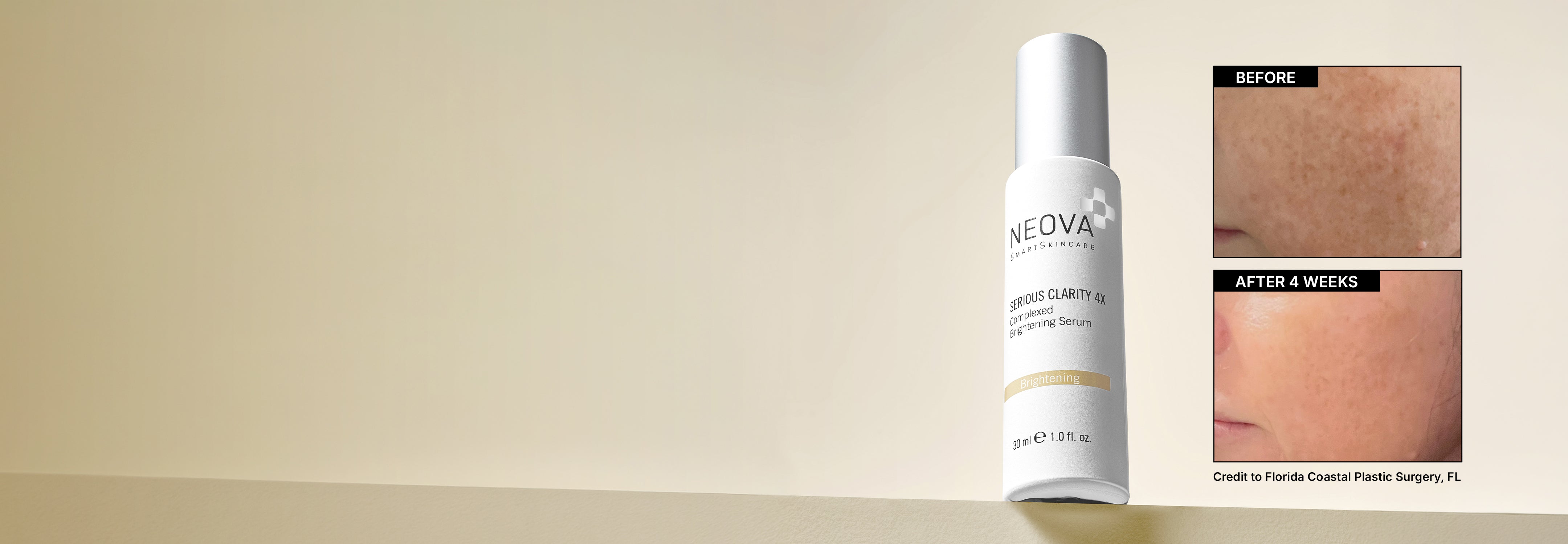 NEOVA - homepage - hero - serious clarity 4x - Brightening serum on a ledge against a golden yellow gradient background. A before and after image comparison is displayed on the right, showing a visible transformation to the cheek area after just 4 weeks.