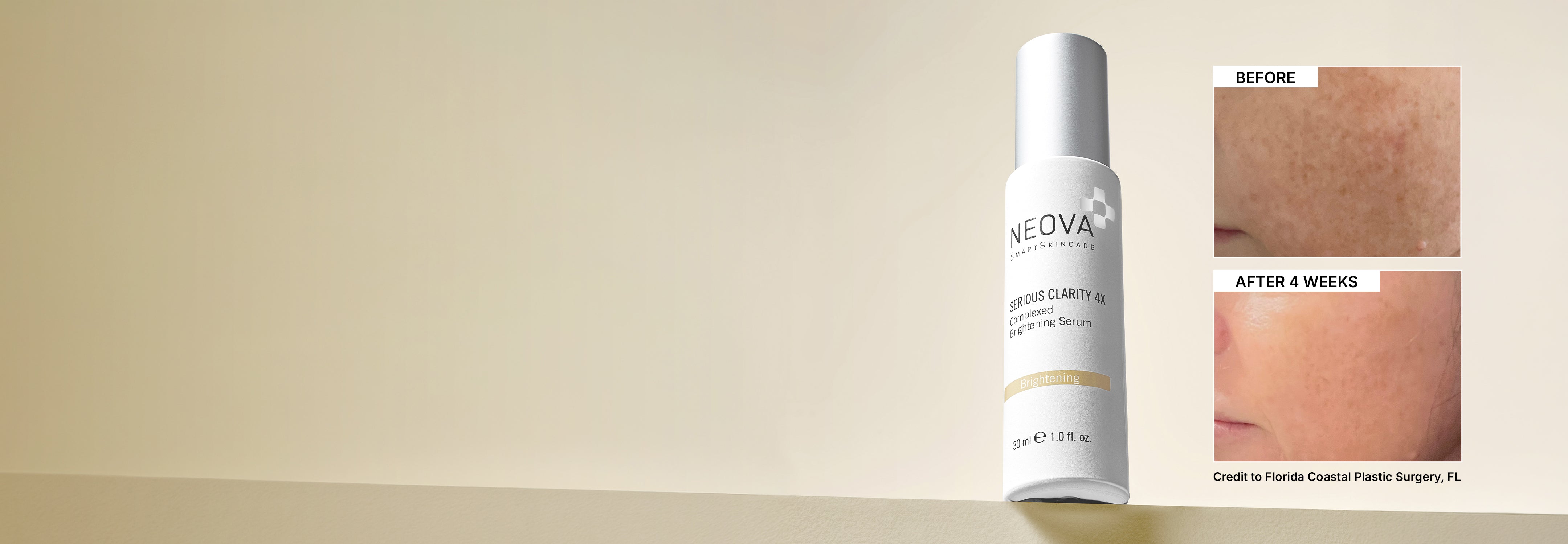 NEOVA - homepage - hero - serious clarity 4x - Brightening serum on a ledge against a golden yellow gradient background. A before and after image comparison is displayed on the right, showing a visible transformation to the cheek area after just 4 weeks.