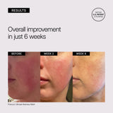NEOVA Ultimate Redness Relief educational image showing clinical before and after results and overall improvement in redness in just 6 weeks, on a gray background.