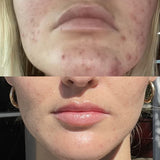 Microfoliant Cleanser - NEOVA