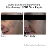 Facial before and after results after four weeks of using NEOVA DNA Total Repair showing improved skin tone and texture