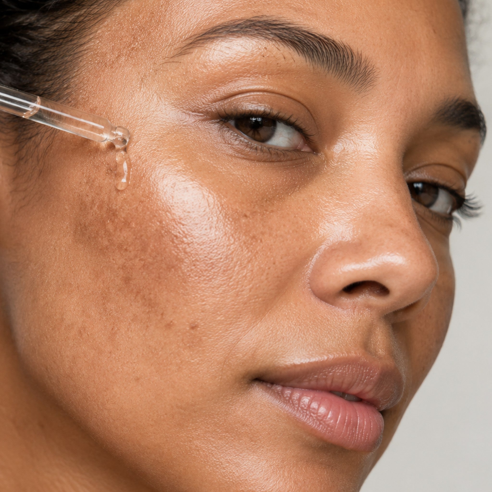 Melasma 101: Why Summer Makes it Worse (and What to do About it)