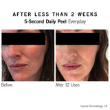 5-Second Daily Peel - NEOVA