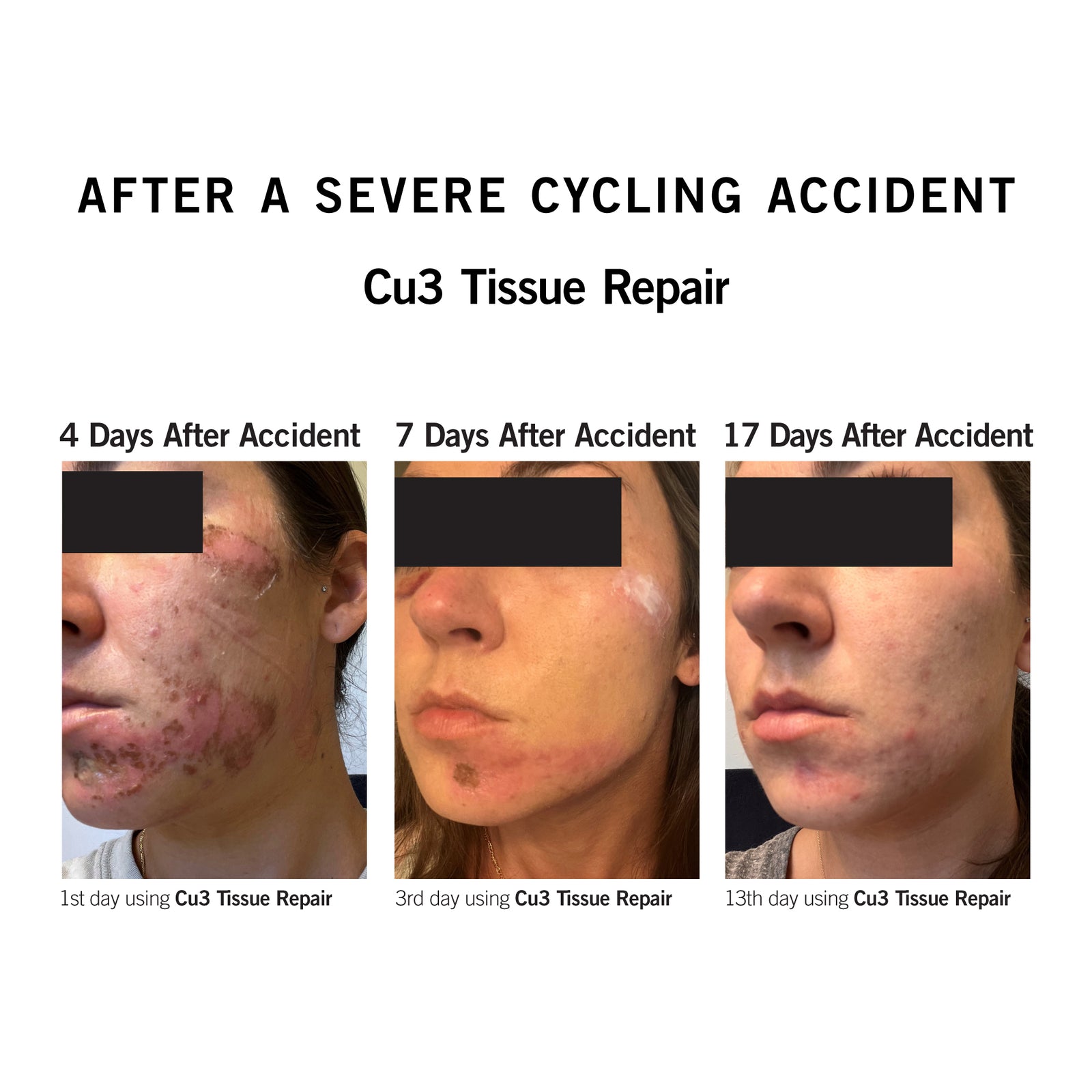 Cu3 Tissue Repair | NEOVA® SmartSkincare