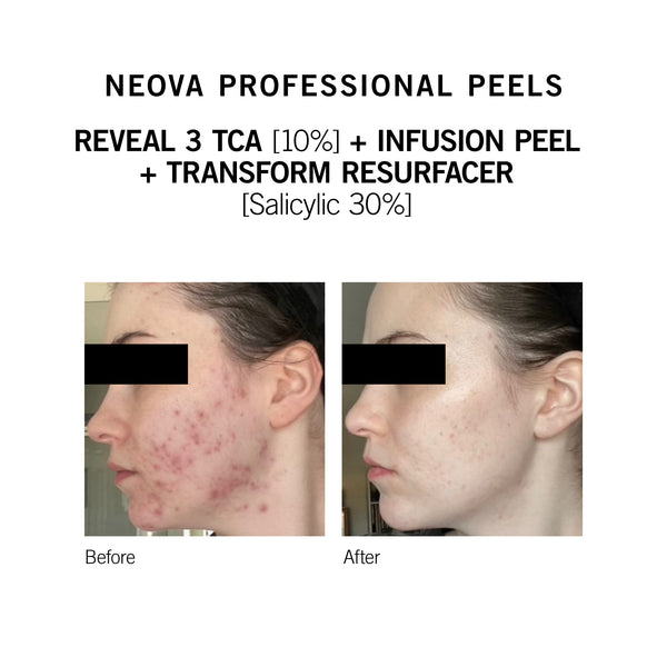 Medical Grade Skincare and Haircare | NEOVA® SmartSkincare