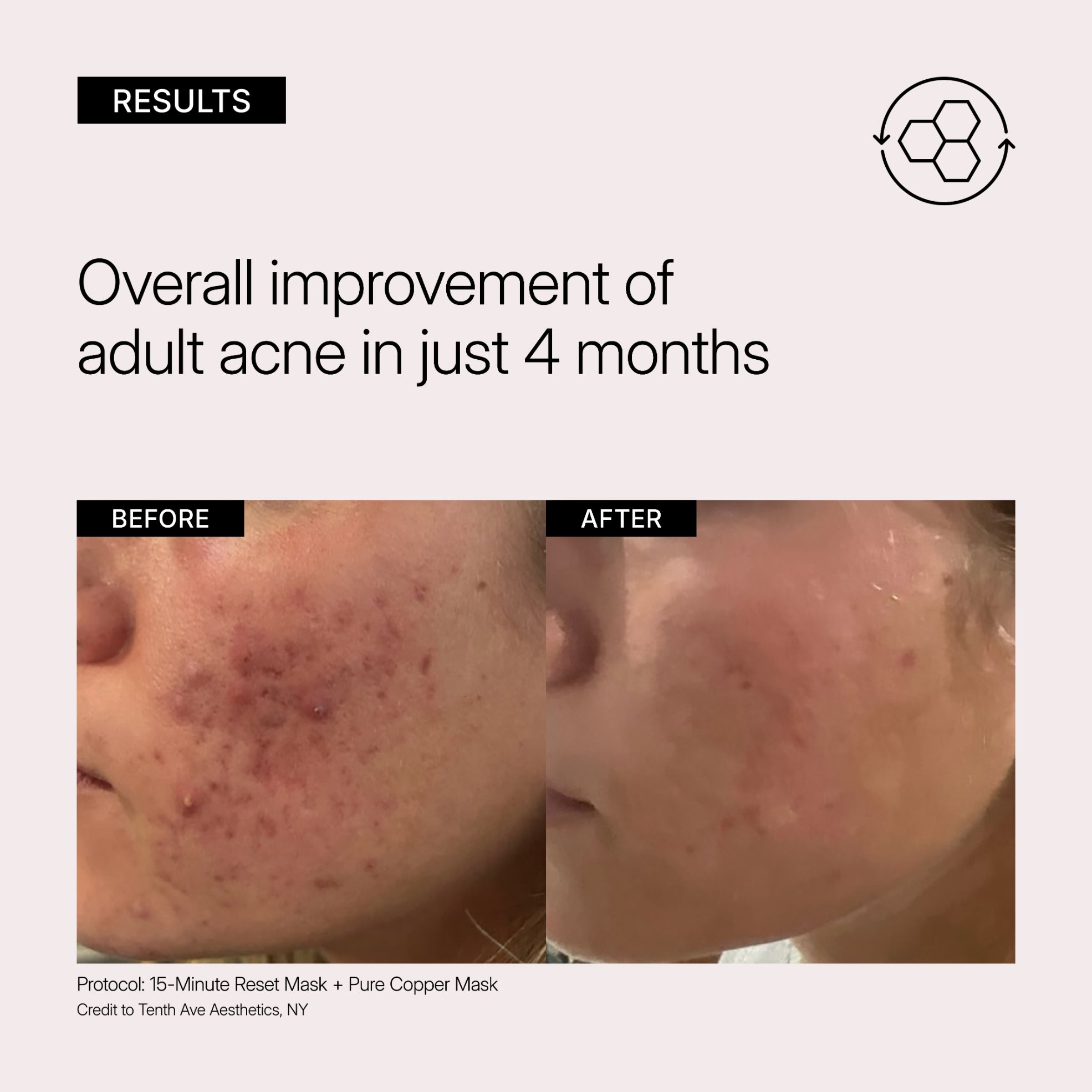 15-Minute Reset Hydrating Mask | NEOVA