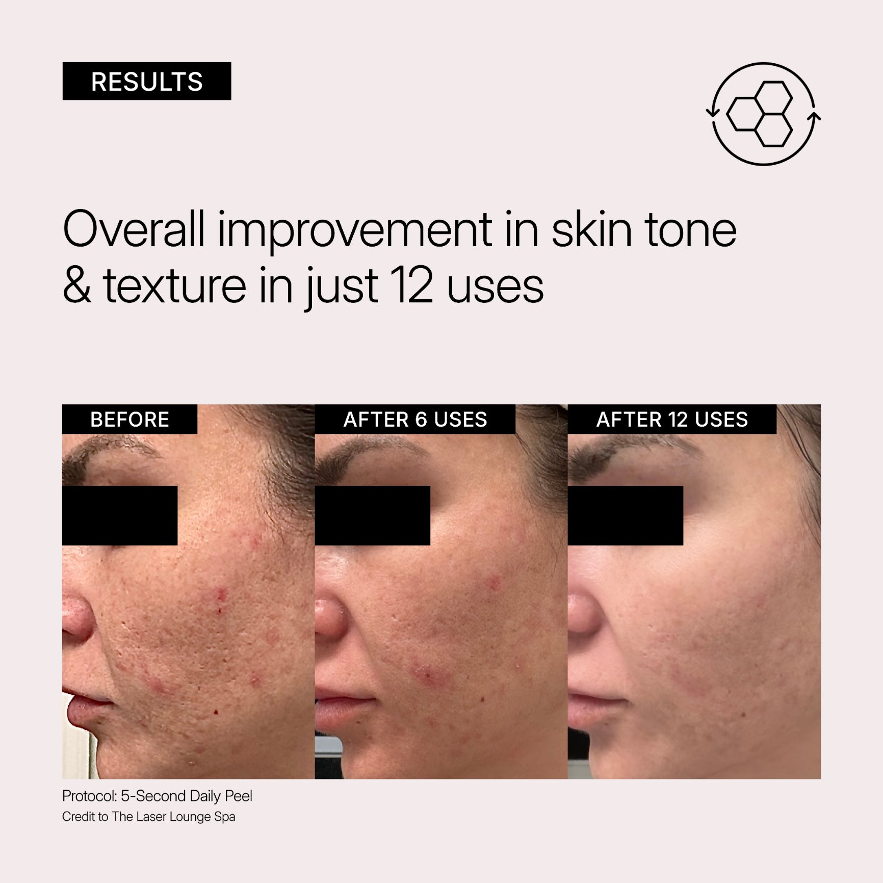 5-Second Daily Peel Pads with AHA/BHA for Smooth Skin | NEOVA