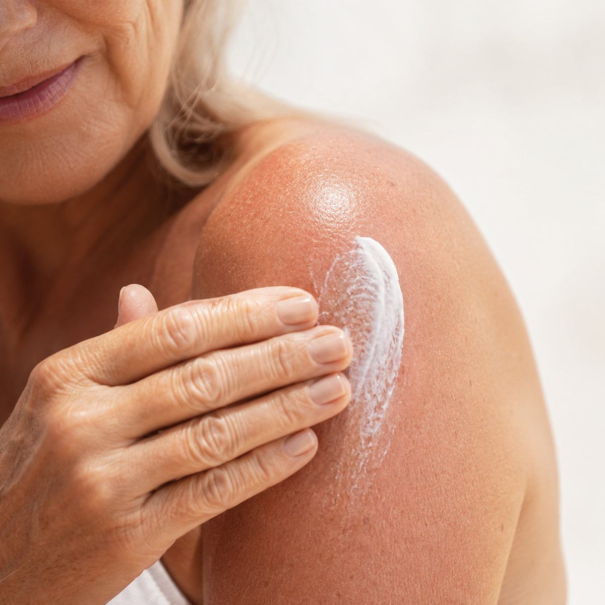 NEOVA - After-Sun Repair Blog - An older woman applies a white cream to her visibly sunburned shoulder as part of her after-sun recovery protocol.