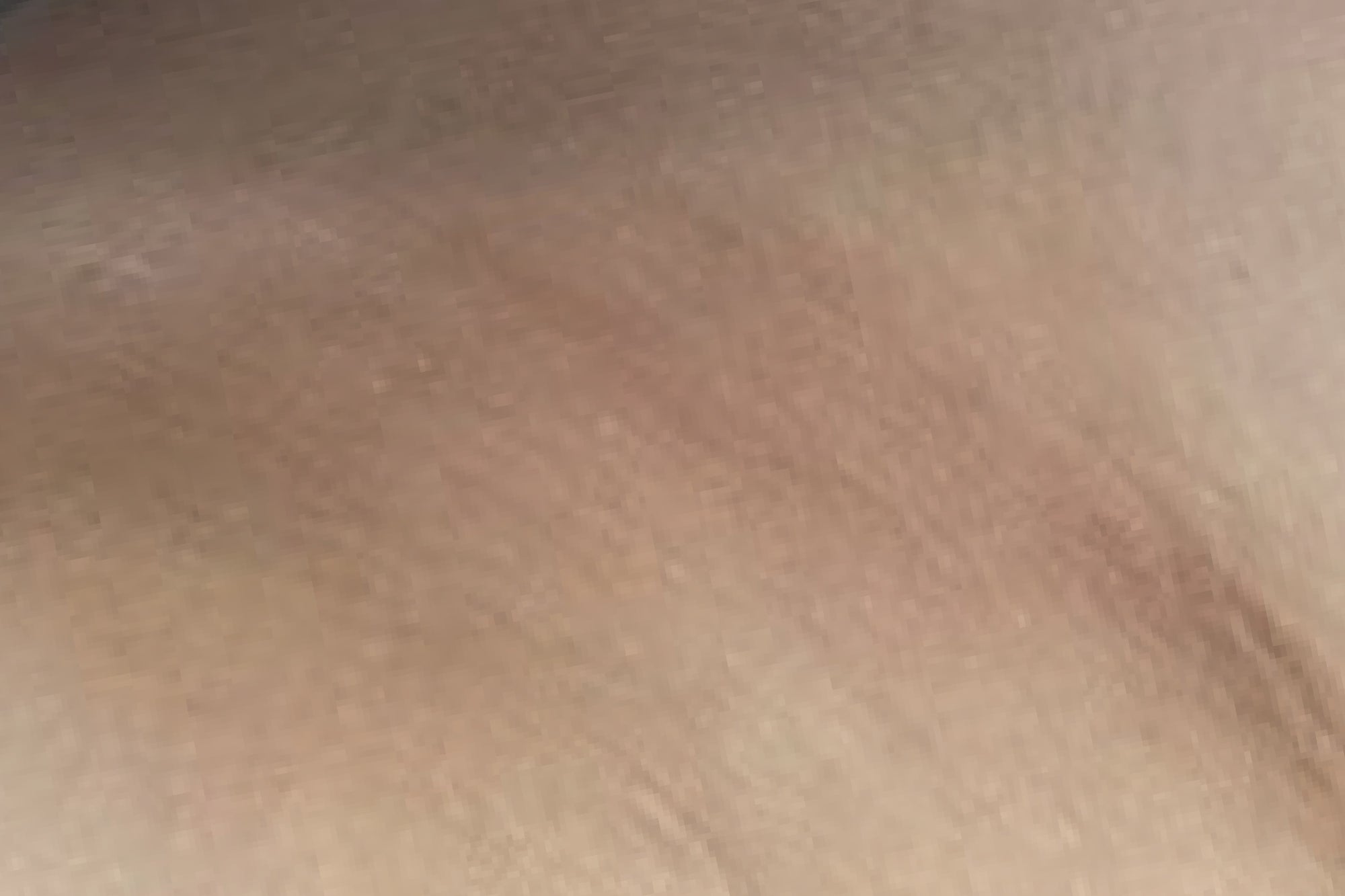 NEOVA Body Repair – after: Close-up of skin showing improved hydration, smoother texture, and more even-looking tone following use of product.