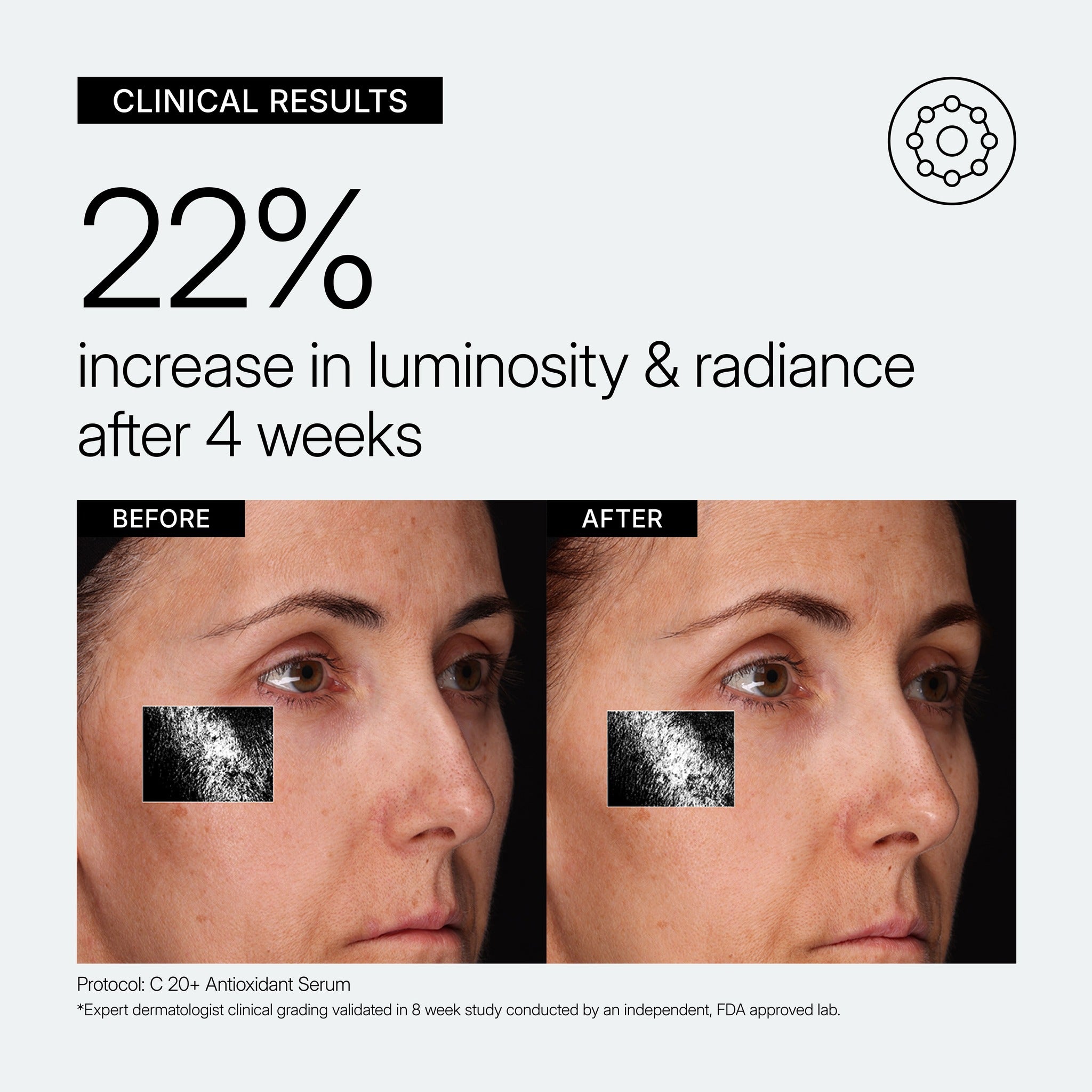 NEOVA C 20+ Antioxidant Serum educational image showing clinical results before and after treatment on the face. Black text reads '22% increase in luminosity & radiance after 4 weeks' on a light background.