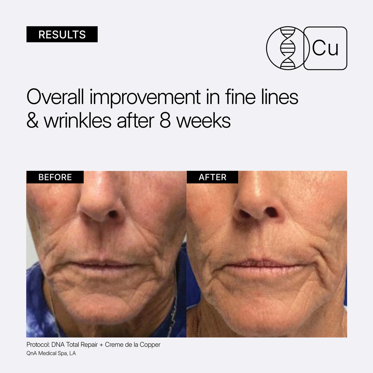 NEOVA Crème de la Copper educational image showing clinical before and after results with 'Overall improvement in fine lines & wrinkles after 8 weeks' on a light background.