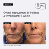 NEOVA Crème de la Copper educational image showing clinical before and after results with 'Overall improvement in fine lines & wrinkles after 8 weeks' on a light background.