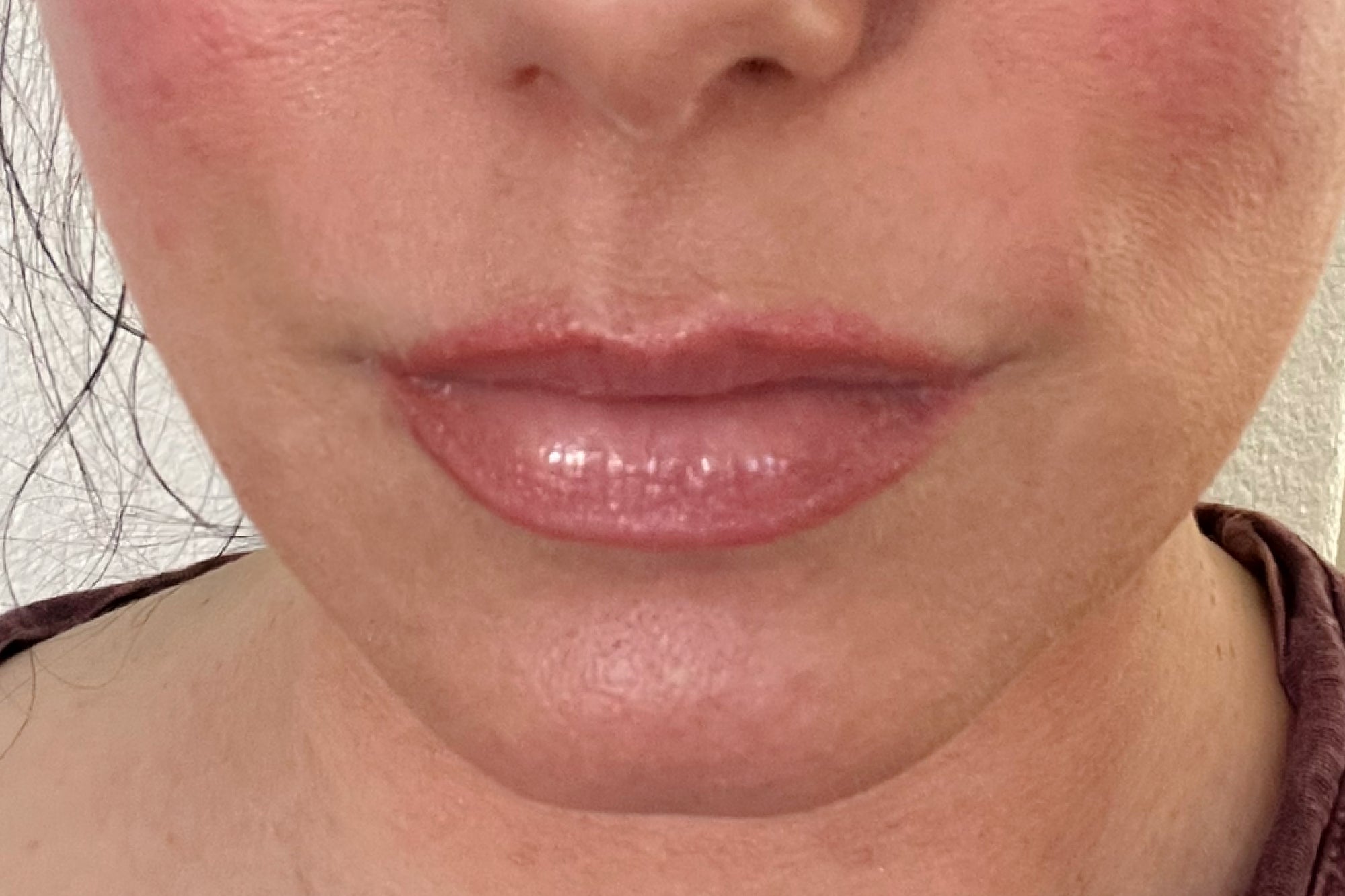 NEOVA CU3 Lip Repair – after: Close-up of lips showing smoother-looking texture, improved hydration, and softened appearance of fine lines following use of product.