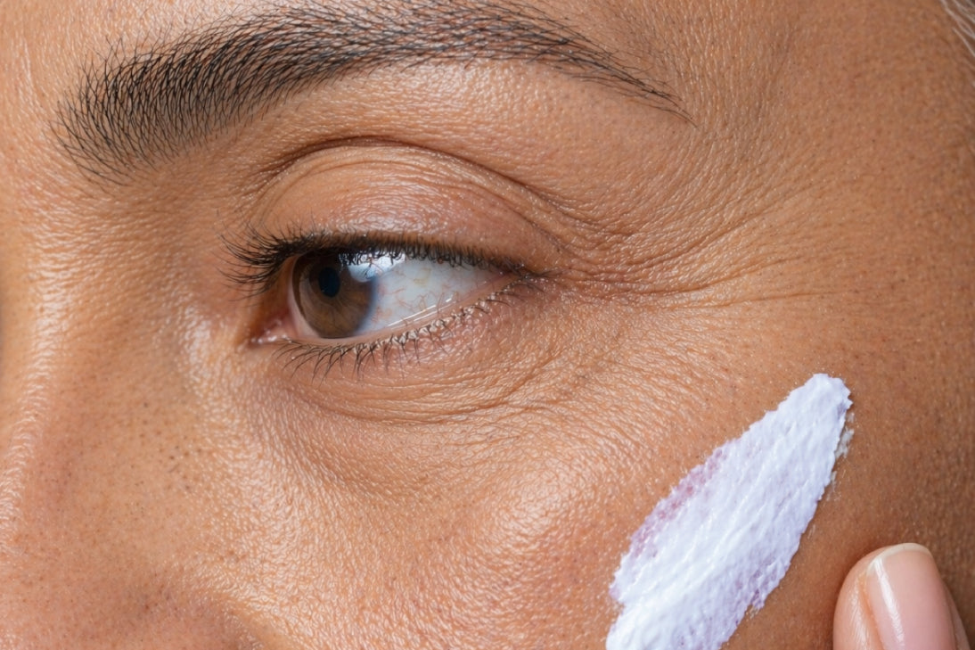 NEOVA CU3 Recovery Lotion – application: Close-up of cheek showing lightweight recovery lotion being applied to soothe irritation, support skin repair, and strengthen the skin barrier.