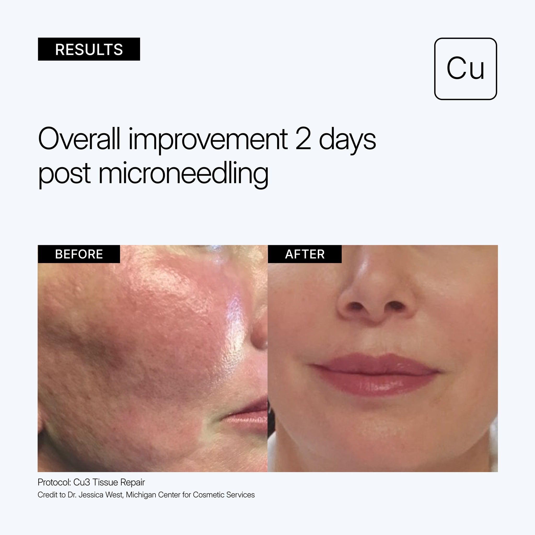 Copper Peptide Post-Procedure Cream | NEOVA