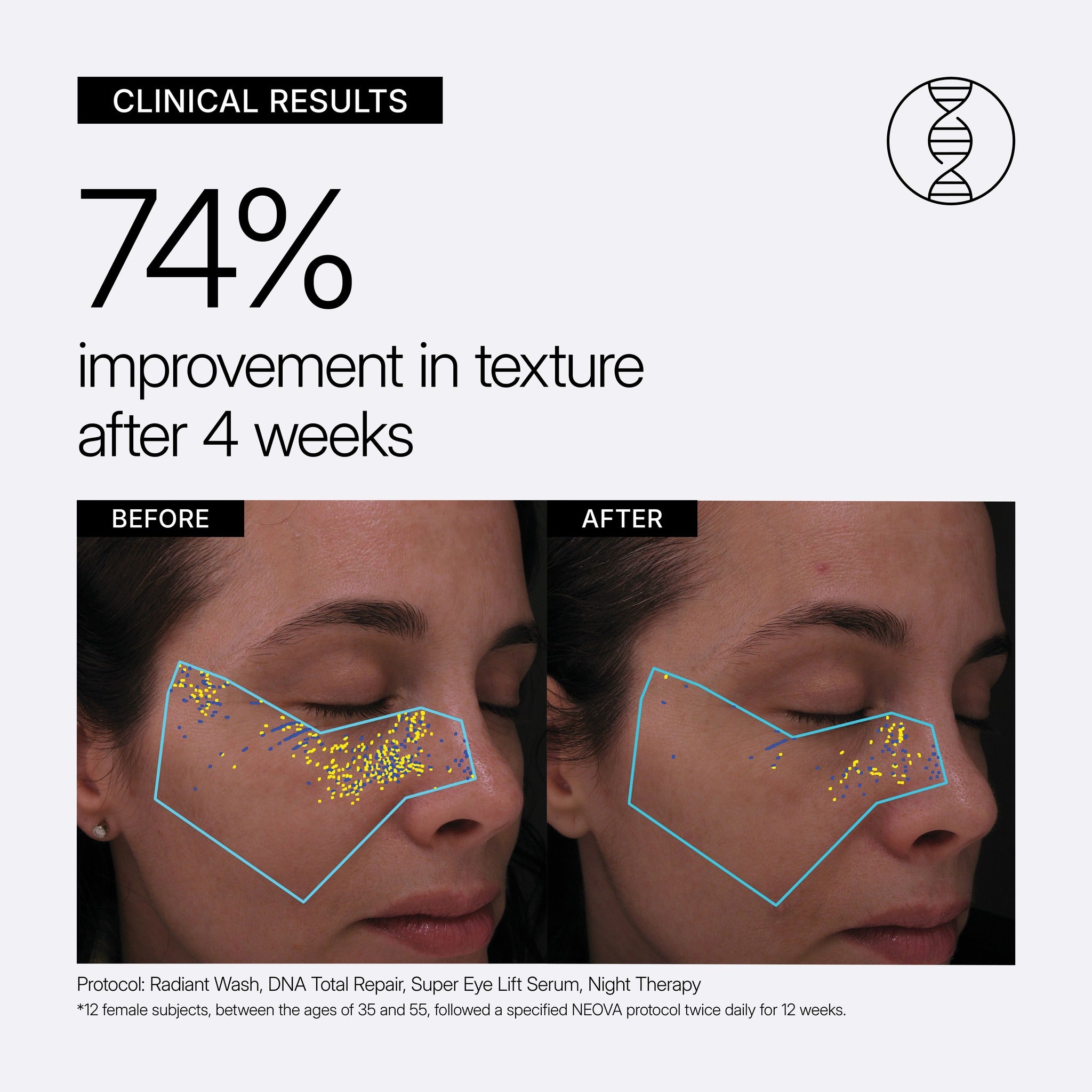 NEOVA DNA Total Repair educational image showing clinical before and after results with '74% improvement in texture after 4 weeks' on a gray background.