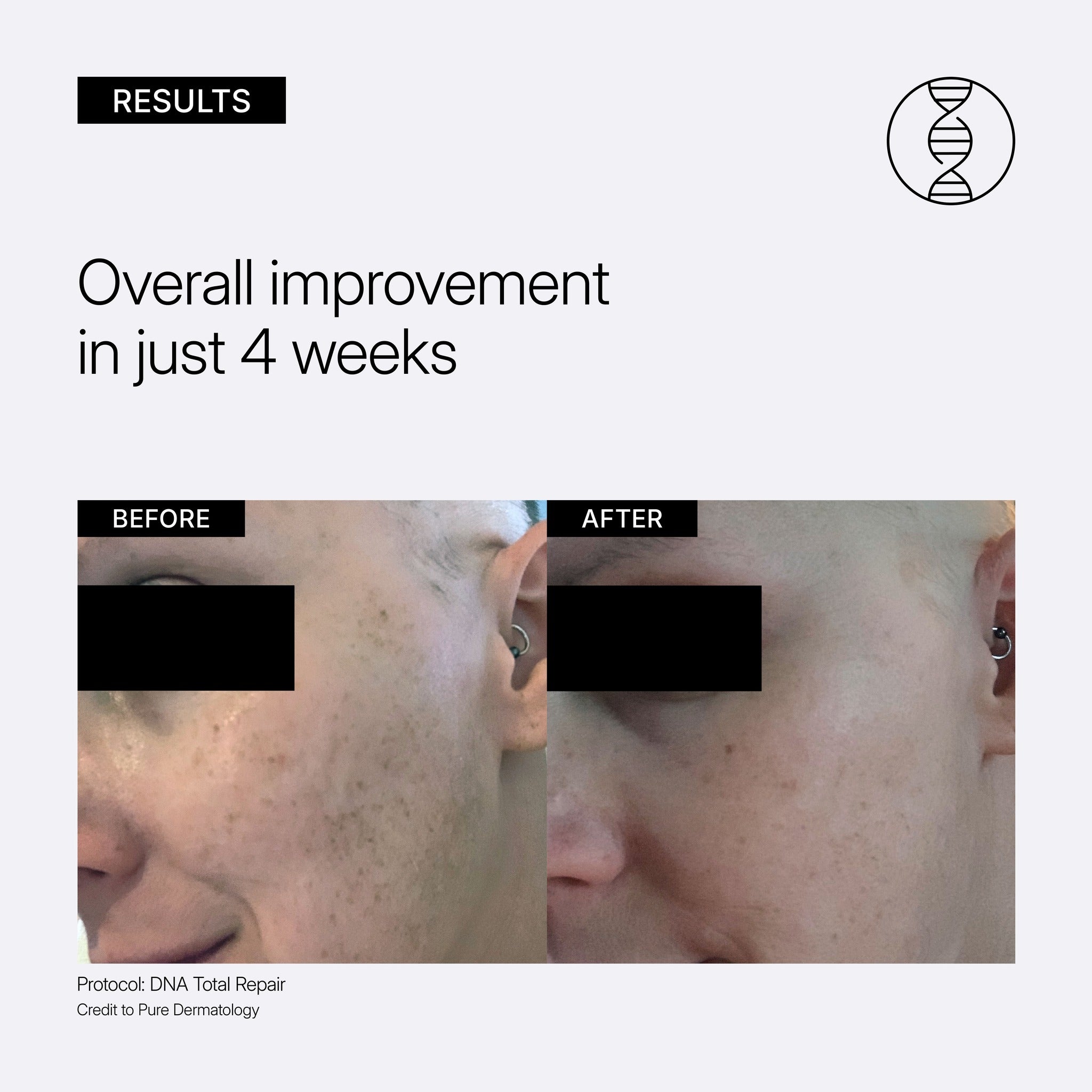 NEOVA DNA Total Repair educational image showing clinical before and after results with 'Overall improvement in just 4 weeks' on a gray background.