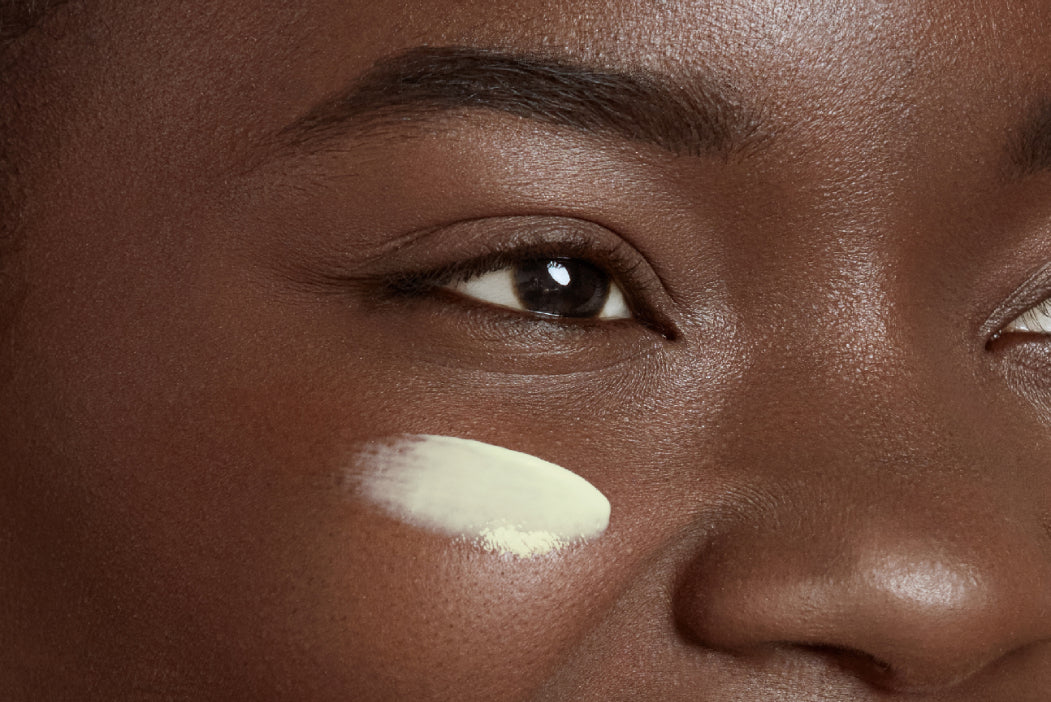 NEOVA Dual Matrix – application: Close-up of cheek showing anti-aging treatment being applied to improve skin firmness, reduce fine lines, and support collagen production.