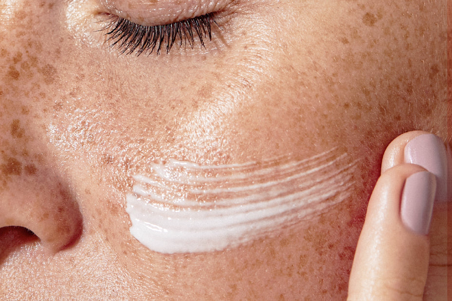 NEOVA Multi-Active Day Cream – application: Close-up of face with freckles showing daily moisturizer being applied to hydrate skin, protect against environmental stressors, and improve overall skin tone.