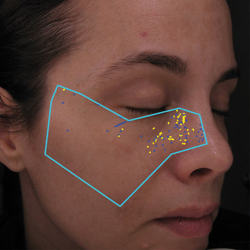 NEOVA Science - DNA Repair After - Facial scan with blue outline and a reduction of yellow dots on a person's face.