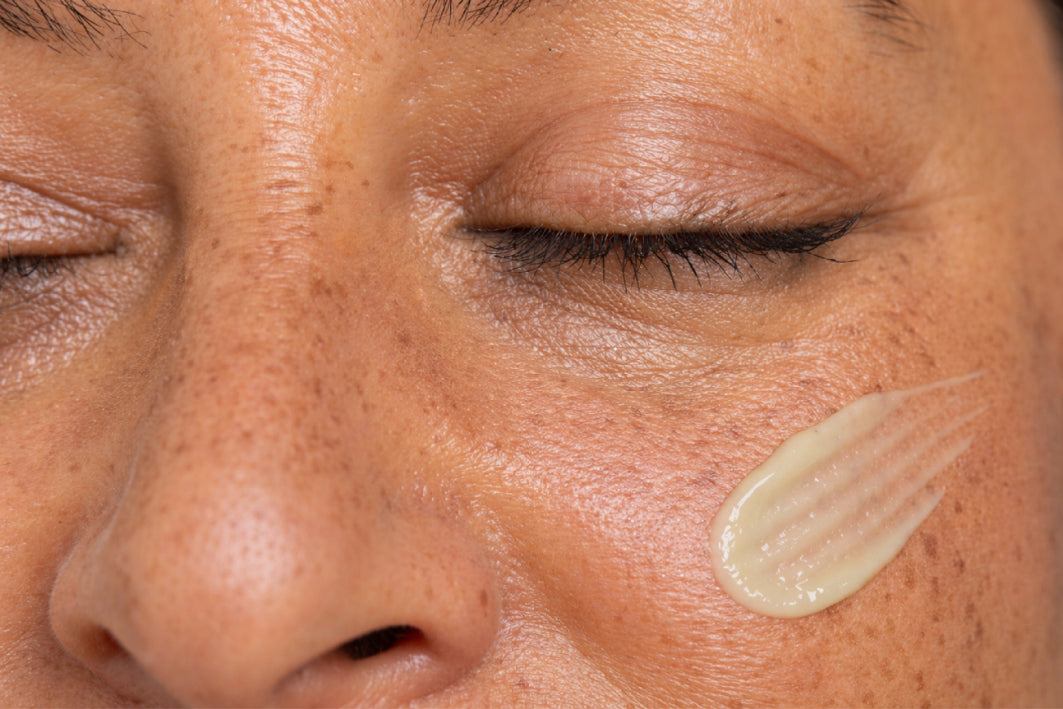 NEOVA Serious Clarity – application: Close-up of cheek showing treatment cream being applied to improve uneven skin tone, refine texture, and enhance overall skin clarity.