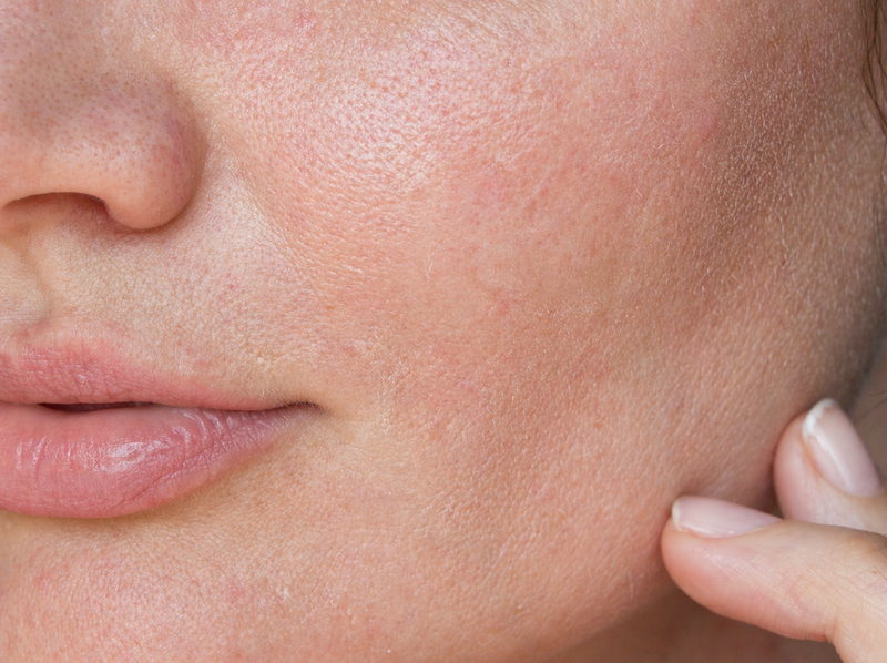 NEOVA - Shop by Concern: Dry Skin - Close-up of a person's neck and jawline with visible dry skin texture.