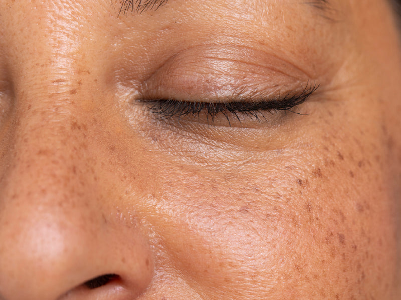 NEOVA - Shop by Concern:  Sun Protection - Close-up of a person's eye with visible wrinkles and textured skin caused by UVs.