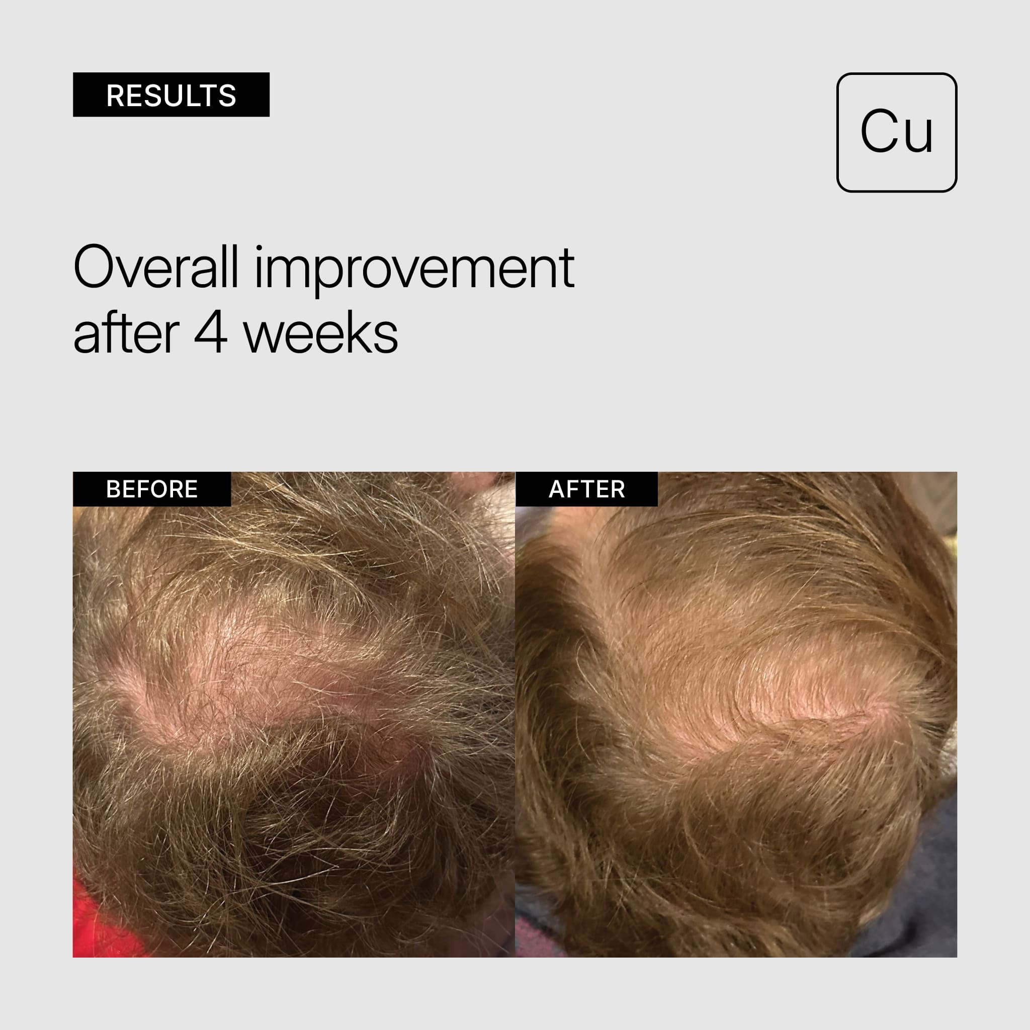 Tricomin Hair Strengthening System | NEOVA
