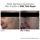 Facial before and after results after four weeks of using NEOVA DNA Total Repair showing improved skin tone and texture
